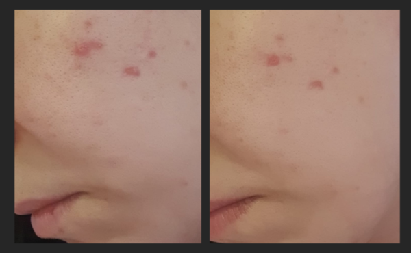 OGGUSTO Beauty Club Deniyor: Caudalie Vinoperfect Serum