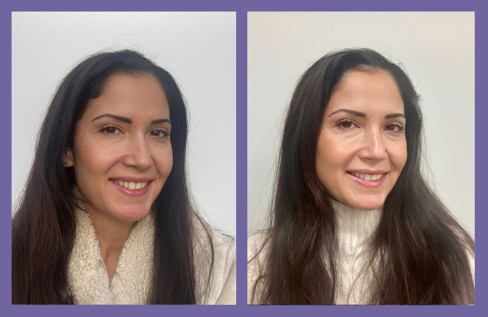 OGGUSTO Beauty Club Deniyor: Lancôme Rénergie Triple Serum