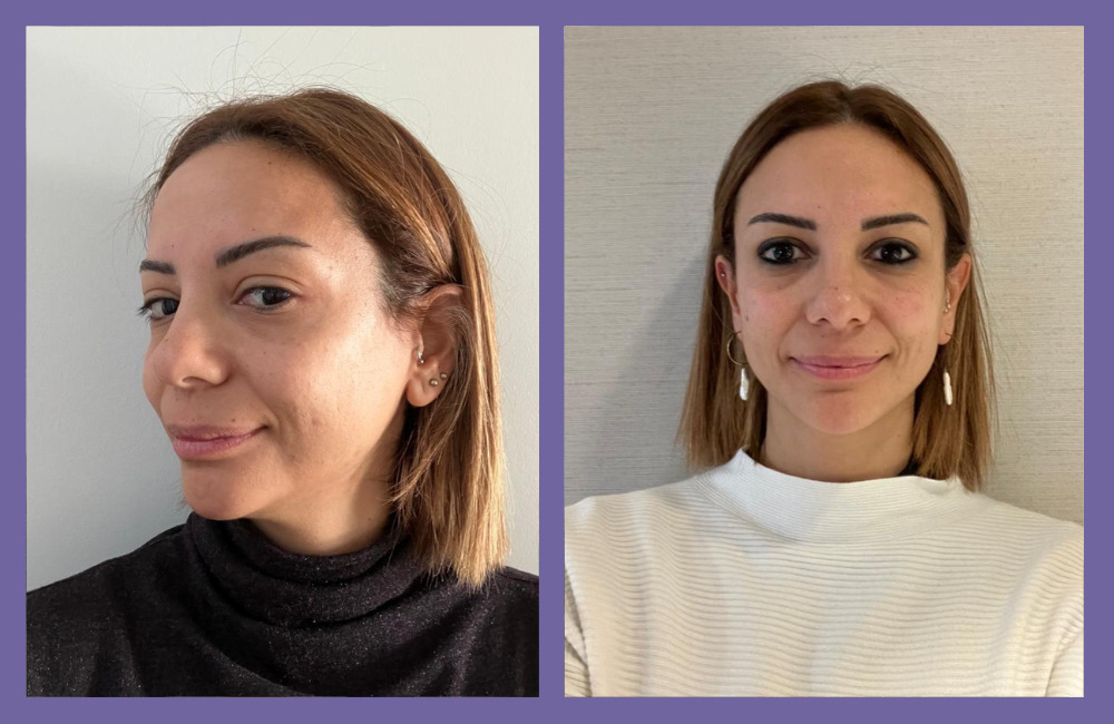 OGGUSTO Beauty Club Deniyor: Lancôme Rénergie Triple Serum