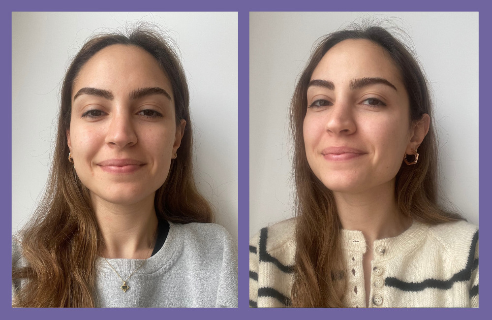 OGGUSTO Beauty Club Deniyor: Lancôme Rénergie Triple Serum