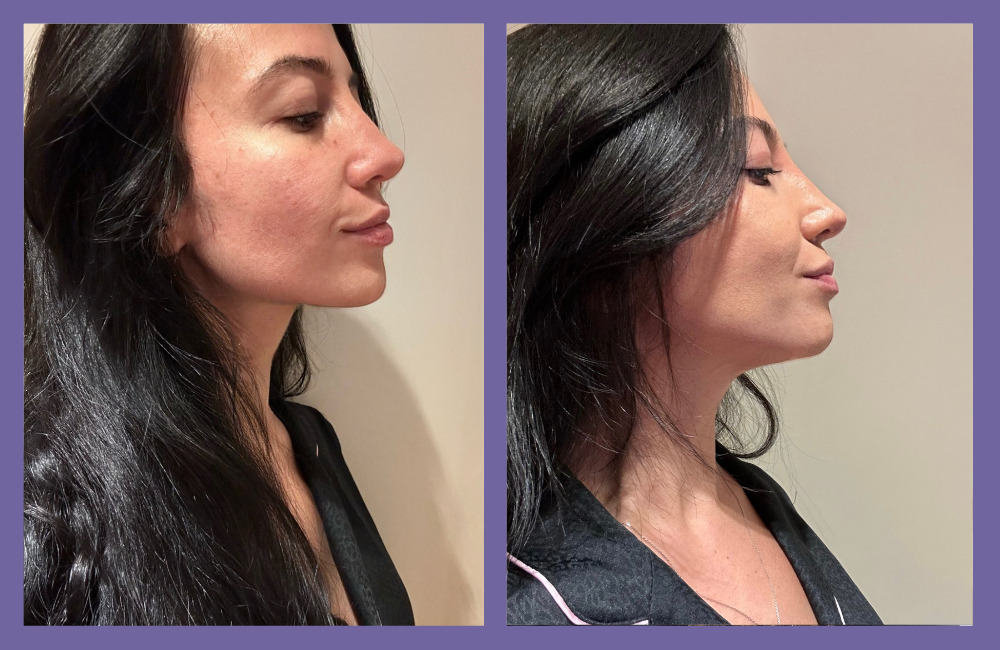 OGGUSTO Beauty Club Deniyor: Lancôme Rénergie Triple Serum