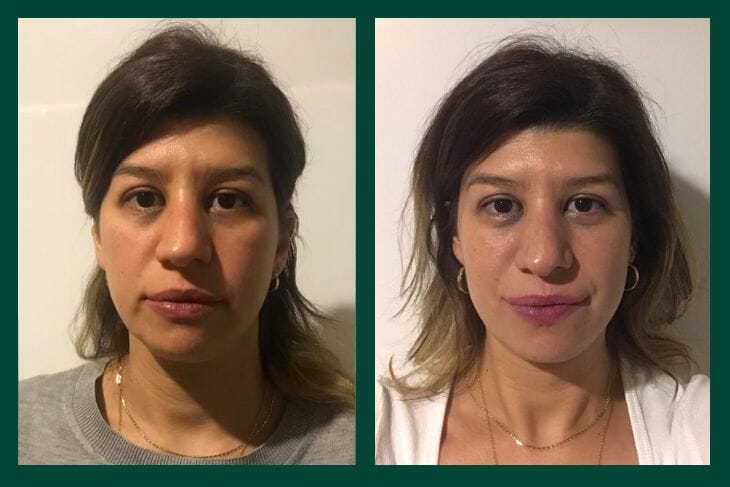 OGGUSTO Beauty Club Deniyor: Nuxe Super Serum ve Merveillance Lift Krem