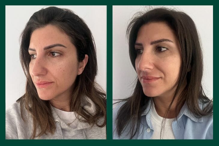 OGGUSTO Beauty Club Deniyor: Nuxe Super Serum ve Merveillance Lift Krem