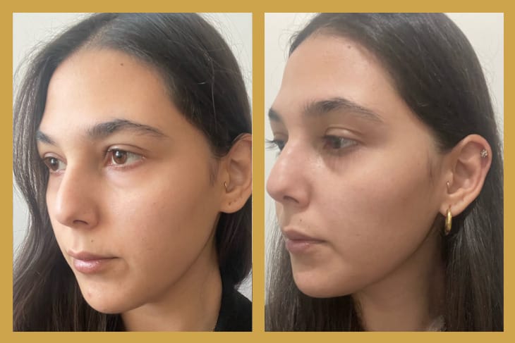 OGGUSTO Beauty Club Deniyor: Darphin Yapay Zeka Cilt Analizi