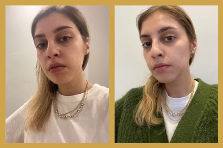 OGGUSTO Beauty Club Deniyor: Darphin Yapay Zeka Cilt Analizi