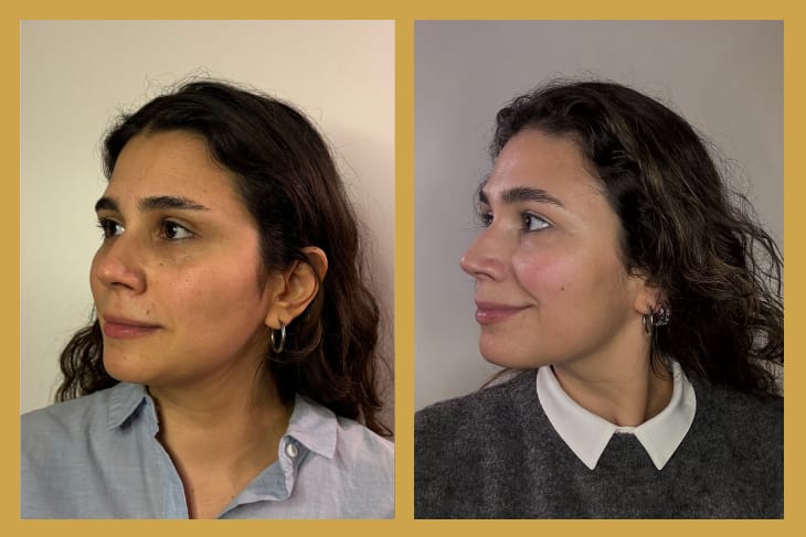 OGGUSTO Beauty Club Deniyor: Darphin Yapay Zeka Cilt Analizi