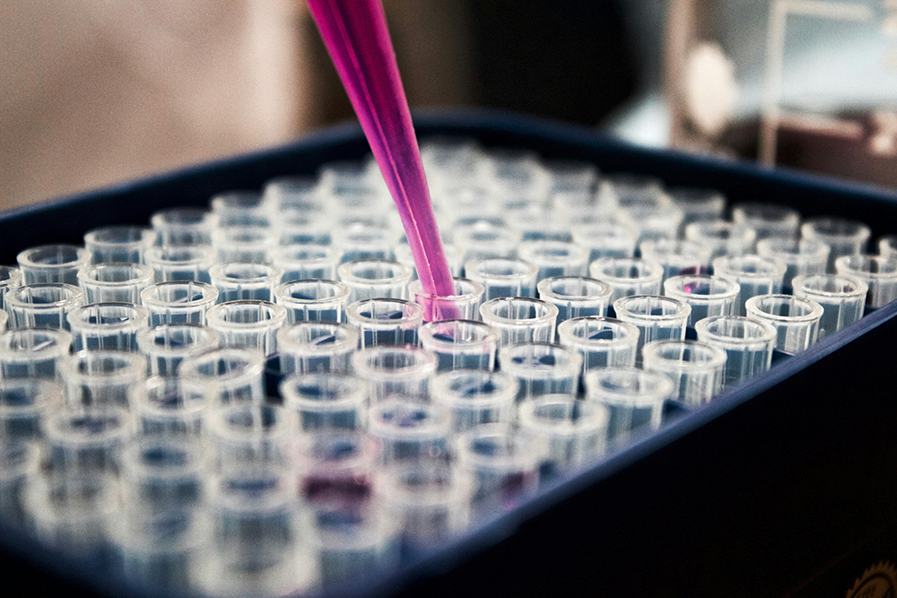 Longevity çalışmalarının ve sağlıklı yaşam hedeflenen araştırmaların temelini oluşturan hassas laboratuvar analizlerini temsil eden bu net görselde, pembe bir pipet ucu, şeffaf küçük test tüplerinden birine morumsu bir sıvı aktarırken yakın plandan çekilmiştir.