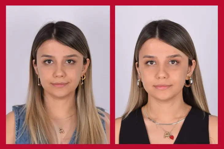 OGGUSTO Beauty Club Deniyor: Bioderma MATRICIUM™