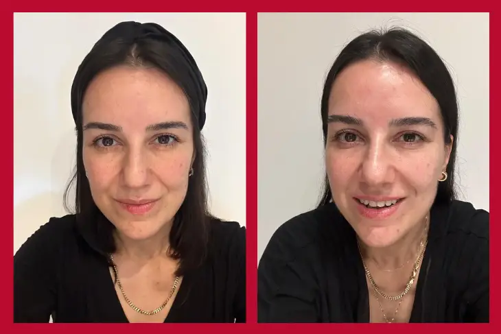 OGGUSTO Beauty Club Deniyor: Bioderma MATRICIUM™