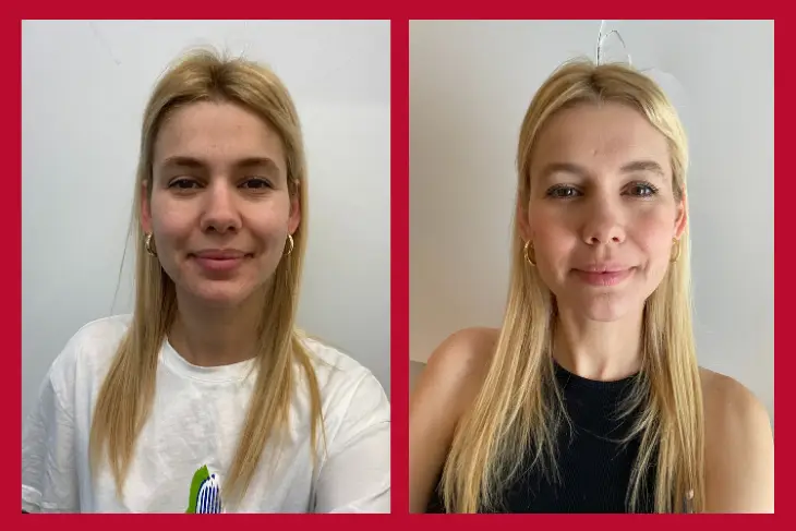 OGGUSTO Beauty Club Deniyor: Bioderma MATRICIUM™